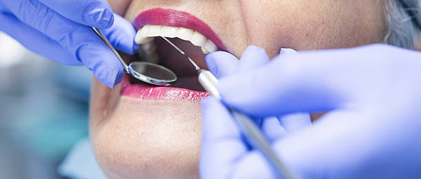 Best Emergency Tooth Extraction in Sudan, TX